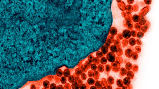 VIH (orange) à la surface d&#039;une cellule infectée (vert)
