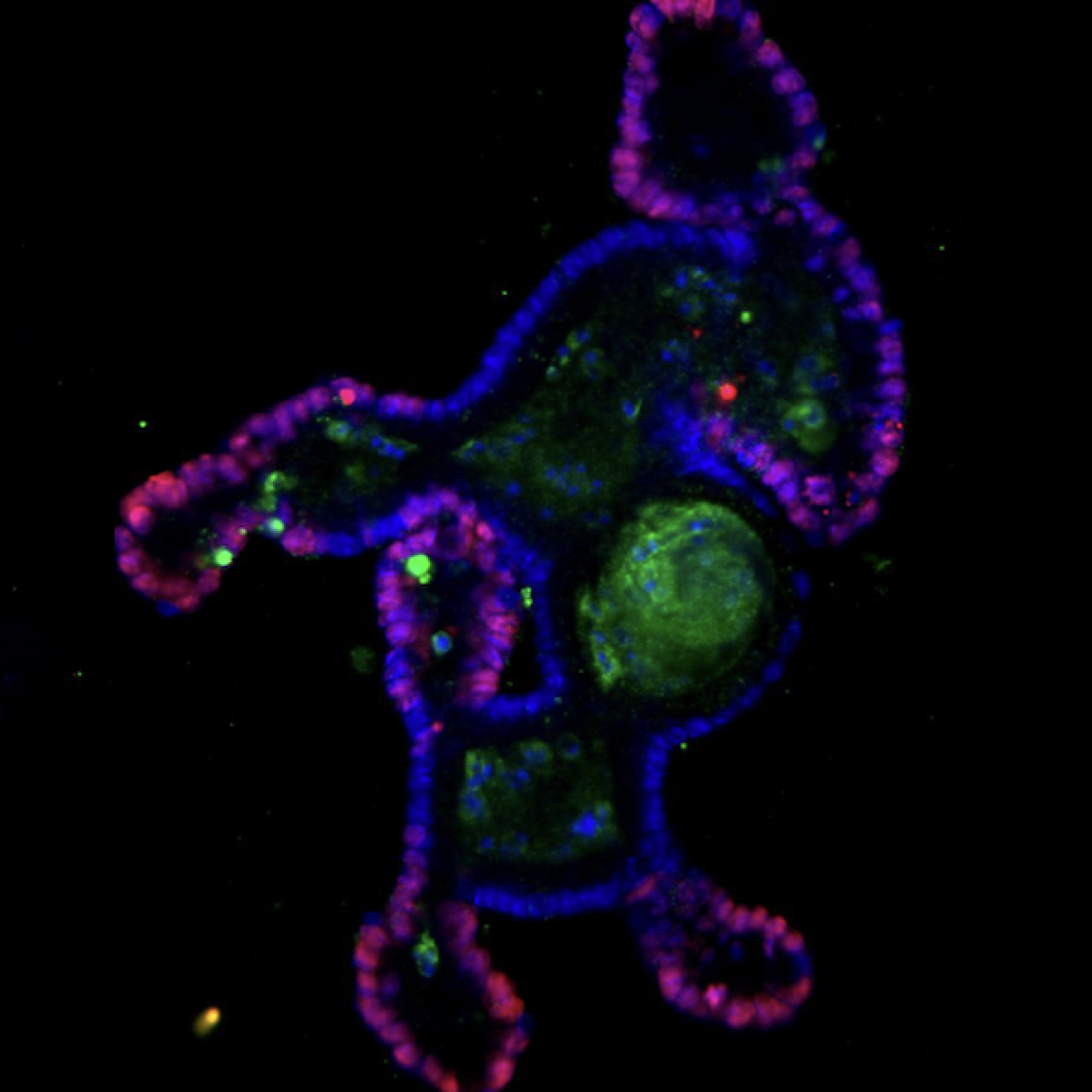 photo microscopie à fluorescence projet Axine 1 et tumorigenèse intestinale