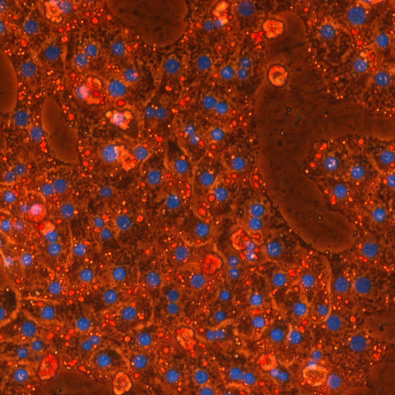 image microscopie projet Métabolisme lipidique, mitochondrie et maladies métaboliques équipe Bouillaud